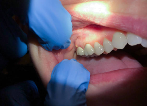Best After-Hours Emergency Dentist in Dade City North, FL