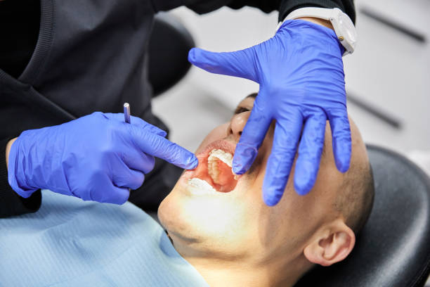 Best Emergency Tooth Extraction in Dade City North, FL