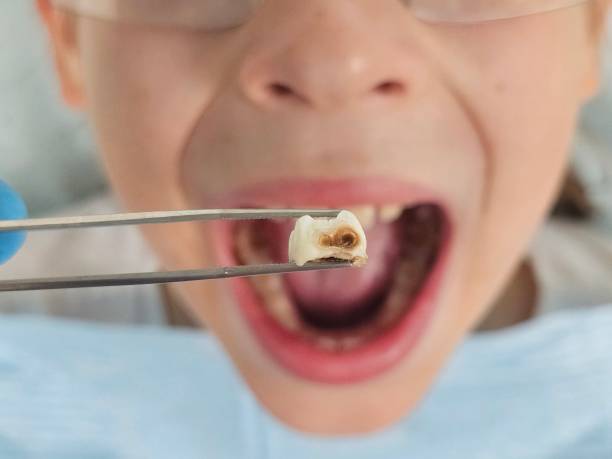 Best Emergency Dental Surgery in Dade City North, FL
